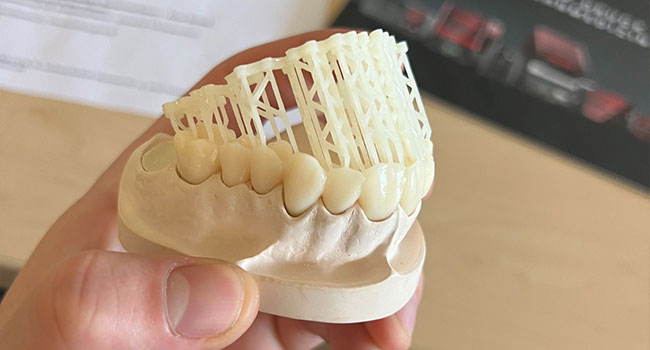 3D-Druck in der Zahnarztpraxis